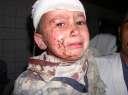 A bombed child in Baghdad