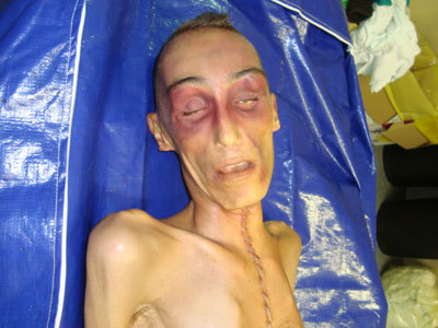 (Italy) Stefano Cucchi: beaten and killed in prison